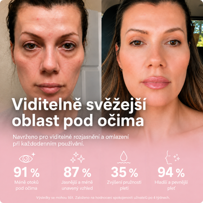 AVIORA: Terapie červeným světlem a mikroproudem