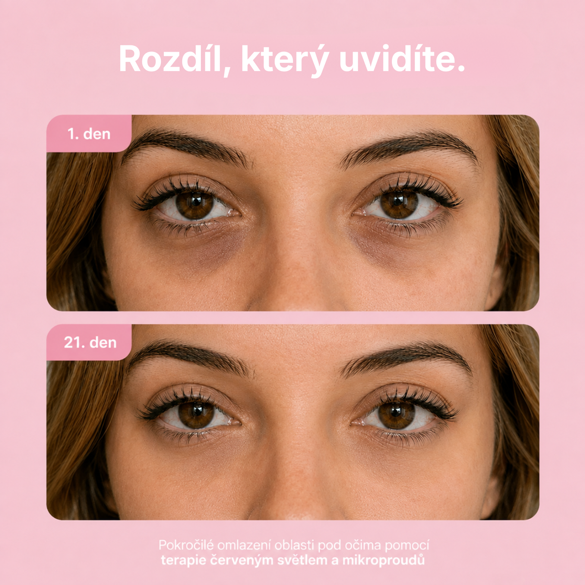 AVIORA: Terapie červeným světlem a mikroproudem