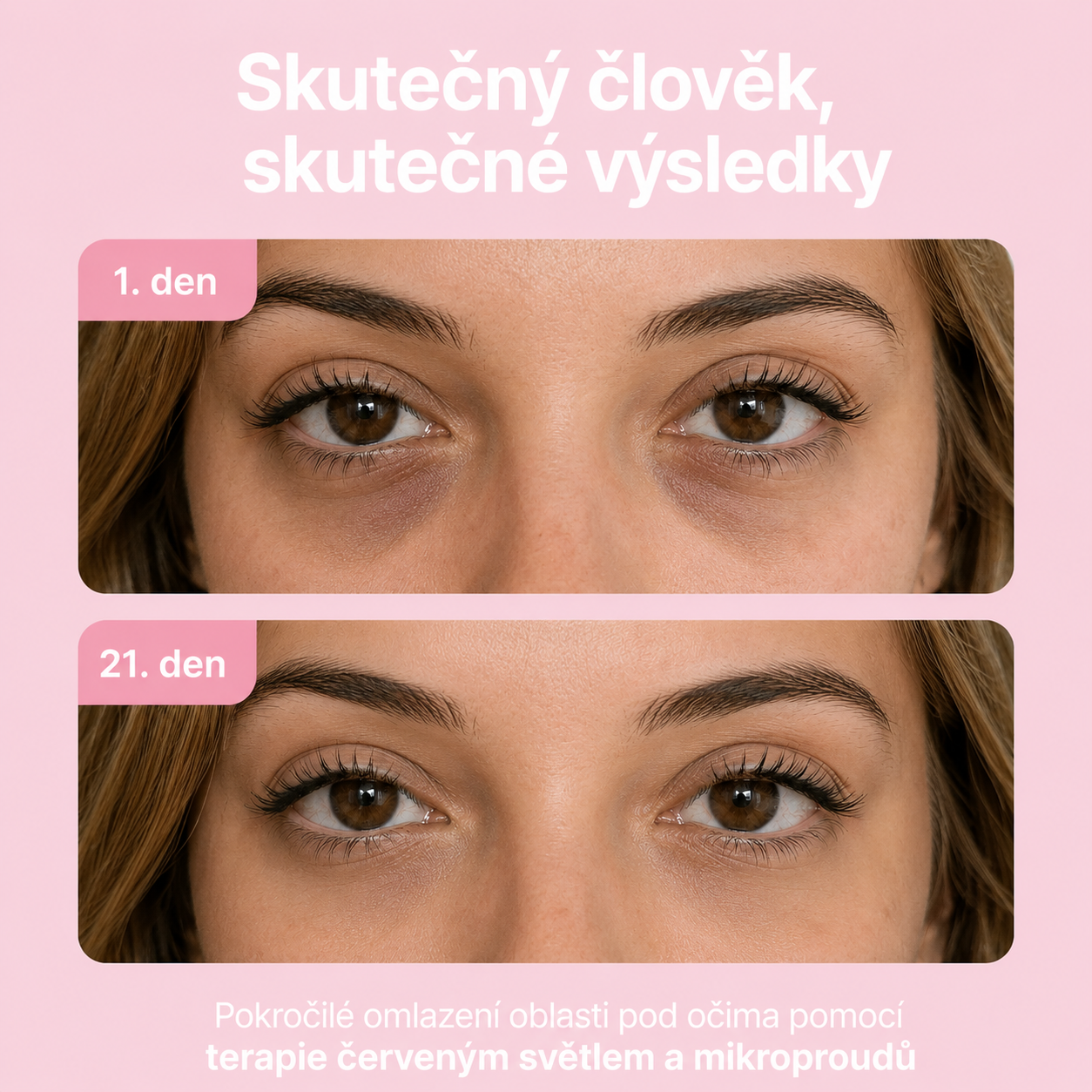 AVIORA: Terapie červeným světlem a mikroproudem