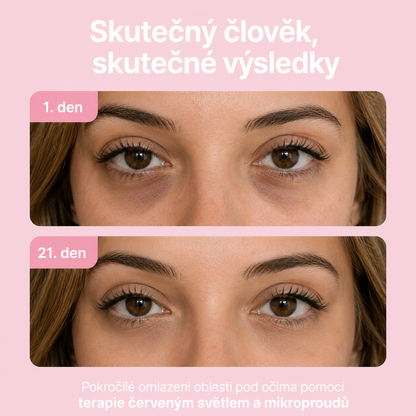 AVIORA: Terapie červeným světlem a mikroproudem
